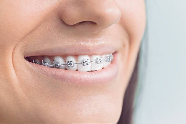 Best Wisdom Tooth Removal  in North Bennington, VT